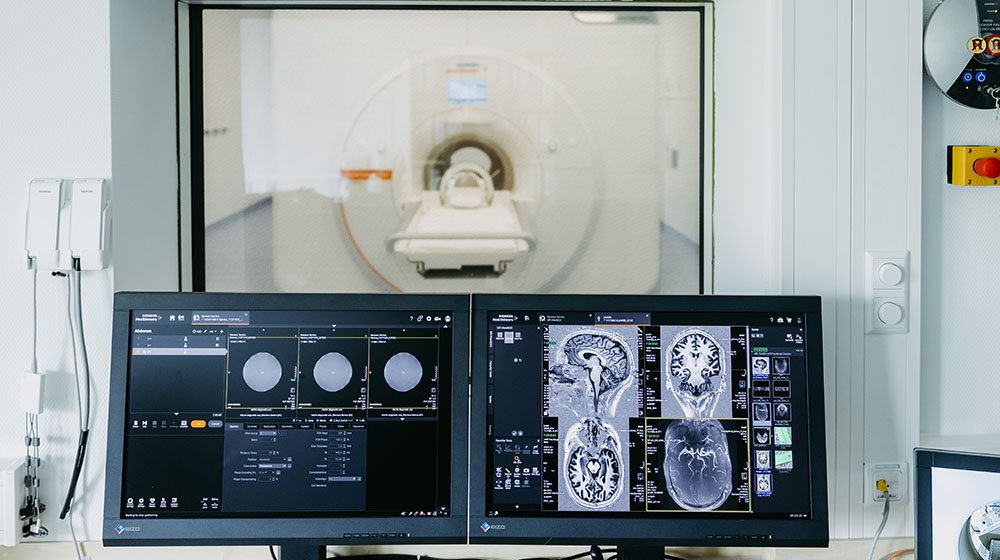 /unimagdeburg_media/Presse/Bilder/Pressemitteilungen/2026/MRT+Gehirnscan+%28Foto_+Jana+Du%CC%88nnhaupt_Uni+Magdeburg%29-height-560-width-1000-p-135278.jpg